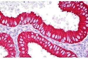 Anti-KRT18 / Cytokeratin 18 antibody IHC staining of human uterus, endometrium. (Cytokeratin 18 Antikörper  (AA 381-430))