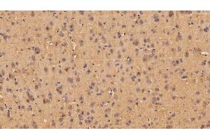 Immunohistochemistry (IHC) image for anti-Angiogenin (ANG) (AA 25-147) antibody (ABIN7430312)