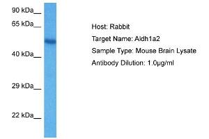 Host: Mouse Target Name: ALDH1A2 Sample Tissue: Mouse Brain Antibody Dilution: 1ug/ml