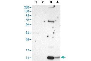 Western Blot analysis of Lane 1: RT-4 cell, Lane 2: U-251 MG sp cell, Lane 3: human plasma tissue (IgG/HSA depleted) and Lane 4: human liver tissue lysates with PPBP polyclonal antibody . (CXCL7 Antikörper)