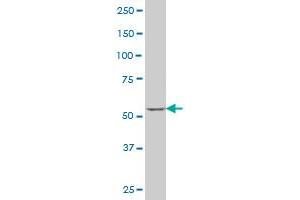 SOX30 monoclonal antibody (M02), clone 6H1 Western Blot analysis of SOX30 expression in MCF-7 . (SOX30 Antikörper  (AA 644-753))