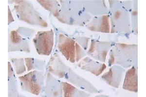 DAB staining on IHC-P; Samples: Rat Skeletal muscle Tissue