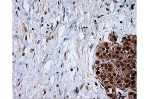 Immunohistochemical staining of paraffin-embedded Kidney tissue using anti-SRR mouse monoclonal antibody. (SRR Antikörper)