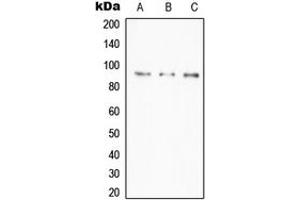 Western blot analysis of A20 expression in HeLa (A), Daudi (B), RAW264. (IGKV1-27 Antikörper  (Center))