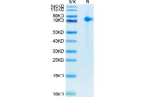 Notch1 Protein (His-Avi Tag,Biotin)