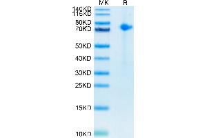 Biotinylated Human Notch 1 on Tris-Bis PAGE under reduced conditions. (Notch1 Protein (His-Avi Tag,Biotin))