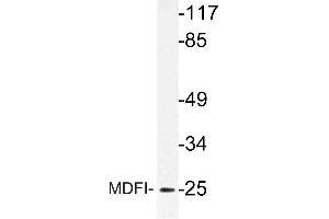 Western blot (WB) analysis of MDFI antibody in extracts from Jurkat cells. (MDFI Antikörper)