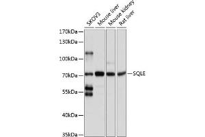 Western blot analysis of extracts of various cell lines, using SQLE antibody (ABIN1513563, ABIN5664074, ABIN5664075, ABIN5664076 and ABIN6219540) at 1:1000 dilution. (SQLE Antikörper  (AA 143-400))