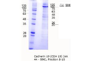 Western Blotting (WB) image for Cadherin 19 (CDH19) (AA 44-596) protein (MBP tag) (ABIN3106579) (CDH19 Protein (AA 44-596) (MBP tag))