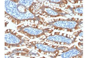 Formalin-fixed, paraffin-embedded human Small Intestine stained with Cytokeratin 8 Rabbit Recombinant Monoclonal Antibody (KRT8/2174R). (Rekombinanter KRT8 Antikörper)