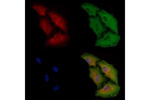 ABIN6261445 and ABIN6278454 staining  cells by IF/ICC.