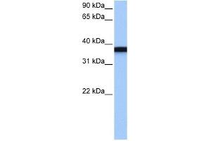 GSG1 antibody used at 1 ug/ml to detect target protein.