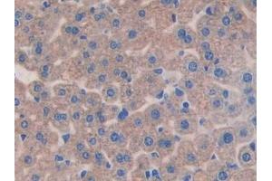 Immunohistochemistry (IHC) image for anti-Interleukin 11 Receptor, alpha (IL11RA) (AA 59-217) antibody (ABIN7437794)