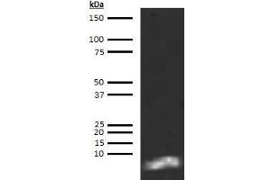 Western Blotting (WB) image for anti-Brain Natriuretic Peptide 45 (BNP-45) antibody (Biotin) (ABIN613019) (BNP-45 Antikörper  (Biotin))