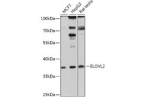 Western blot analysis of extracts of various cell lines, using ELOVL2 antibody (ABIN7266927) at 1:1000 dilution. (ELOVL2 Antikörper  (AA 247-296))