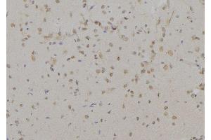 ABIN6277197 at 1/100 staining Mouse brain tissue by IHC-P. (Histone 3 Antikörper  (H3K9me3))