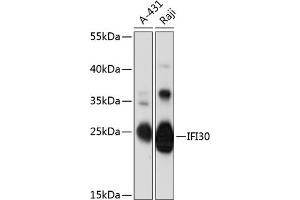 Western blot analysis of extracts of various cell lines, using IFI30 antibody (ABIN6131997, ABIN6142166, ABIN6142167 and ABIN6216814) at 1:3000 dilution.