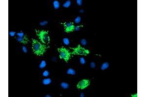 Anti-SIRT5 mouse monoclonal antibody (ABIN2454823) immunofluorescent staining of COS7 cells transiently transfected by pCMV6-ENTRY SIRT5 (RC200189). (SIRT5 Antikörper)
