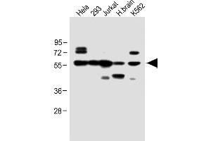 All lanes : Anti-IFNAR1 Antibody (Center) at 1:1000 dilution Lane 1: Hela whole cell lysate Lane 2: 293 whole cell lysate Lane 3: Jurkat whole cell lysate Lane 4: H. (IFNAR1 Antikörper  (AA 162-188))