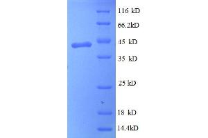 SDS-PAGE (SDS) image for Myopia 2 (High Grade, Autosomal Dominant) (MYP2) (AA 1-132), (full length) protein (GST tag) (ABIN5712550)