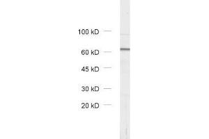 dilution: 1 : 1000, sample: rat brain homogenate (VPS33A Antikörper)