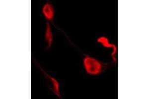 ABIN6278651 staining K562 by IF/ICC. (Ephrin B1/B2/B3 (pTyr324) Antikörper)