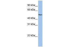 SLC16A6 antibody used at 1 ug/ml to detect target protein. (SLC16A6 Antikörper)