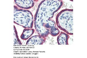 Immunohistochemistry with Human Placenta lysate tissue at an antibody concentration of 5. (ASH2L Antikörper  (Middle Region))