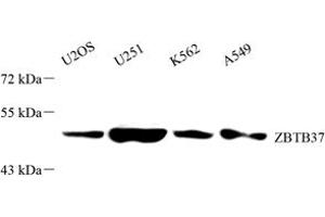 Western blot analysis of ZBTB37 (ABIN7076249) at dilution of 1: 2000