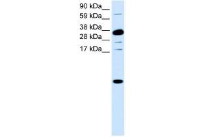 Western Blotting (WB) image for anti-Chemokine (C-X-C Motif) Ligand 1 (Melanoma Growth Stimulating Activity, Alpha) (CXCL1) (Middle Region) antibody (ABIN926926)