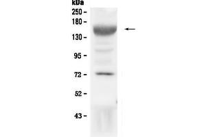 Western blot analysis of IGF1 Receptor using anti-IGF1 Receptor antibody .