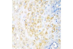 Immunohistochemistry of paraffin-embedded human esophagus using BECN1 antibody at dilution of 1:100 (40x lens).