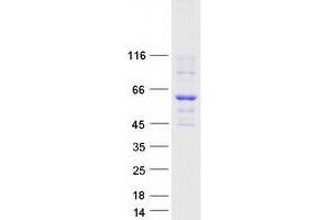 Validation with Western Blot (FAAH Protein (Myc-DYKDDDDK Tag))