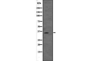 Western blot analysis of VGLL2 expression in VGLL2 transfected 293T cell lysate,The lane on the left is treated with the antigen-specific peptide.