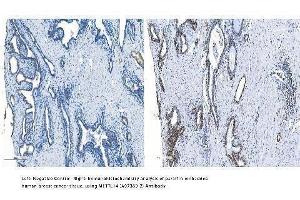 IHC analysis of METTL14 using anti-METTL14 antibody (ABIN7599817). (METTL14 Antikörper  (AA 12-350))