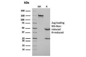 SDS-PAGE (SDS) image for anti-Tumor Protein P73 (TP73) antibody (ABIN6940795)