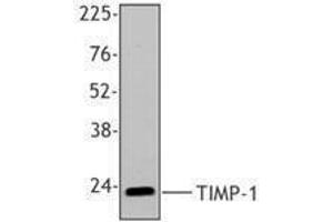 Western Blotting (WB) image for anti-TIMP Metallopeptidase Inhibitor 1 (TIMP1) antibody (ABIN2666373) (TIMP1 Antikörper)