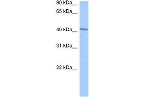 WB Suggested Anti-DCP2 Antibody Titration:  0. (DCP2 Antikörper  (C-Term))