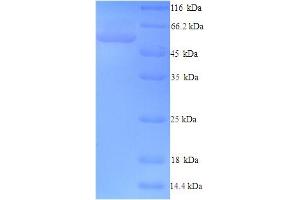 SDS-PAGE (SDS) image for F-Box Protein 3 (FBXO3) (AA 1-471), (full length) protein (His tag) (ABIN5714518)