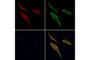 Ribophorin I Antibody staining Hela cells by IF/ICC. (RPN1 Antikörper  (C-Term))