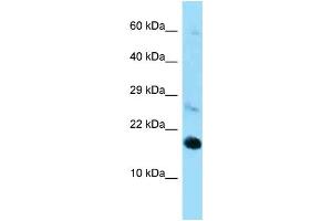 Western Blotting (WB) image for anti-Ribosomal Protein L22 (RPL22) (C-Term) antibody (ABIN2789541) (RPL22 Antikörper  (C-Term))