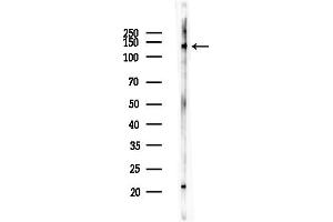 Western blot analysis of lysates from F10-LUC cells(heat-shock, 45 min treatment), using DHX9 Antibody at 1/1000 dilution.