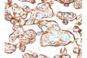 Formalin-fixed, paraffin-embedded human Placenta stained with Thymidine Phosphorylase / PD-ECGF Monoclonal Antibody (P-GF. (Thymidine Phosphorylase Antikörper)