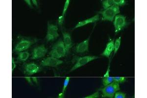 Immunofluorescence analysis of C6 cells using SPARC Polyclonal Antibody at dilution of 1:100 (40x lens). (SPARC Antikörper)
