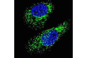 Fluorescent image of  cells stained with LC3 (G8A)  antibody. (MAP1LC3A Antikörper  (AA 91-117))