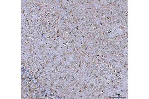 IHC analysis of COX5B using anti-COX5B antibody (ABIN7598975). (COX5B Antikörper  (AA 1-129))