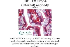 Image no. 1 for anti-Transmembrane Protease, serine 4 (TMPRSS4) (Internal Region) antibody (ABIN1740176) (TMPRSS4 Antikörper  (Internal Region))
