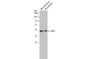 WB Image Various tissue extracts (50 μg) were separated by 10% SDS-PAGE, and the membrane was blotted with RAP antibody [N1C3] , diluted at 1:1000. (LRPAP1 Antikörper  (Center))