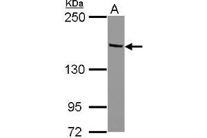 Western Blotting (WB) image for anti-Tripartite Motif Containing 24 (TRIM24) (AA 82-399) antibody (ABIN1501502)