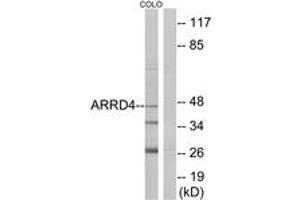 Western blot analysis of extracts from COLO cells, using ARRD4 Antibody. (ARRD4 Antikörper  (AA 127-176))